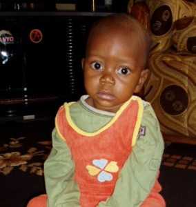 Simon is 1 year old. His parents were informed that Simon would not have long to live. He was born with congenital heart defect and there are no facilities in Zambia to perform heart surgery. 
