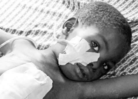 A Typhoid Fever victim in Africa